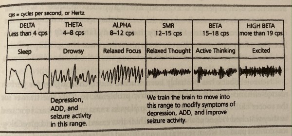 EEG Summary